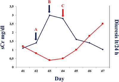 Case Report: Tocilizumab for Acute Kidney Graft Dysfunction in Patient Affected by COVID-19